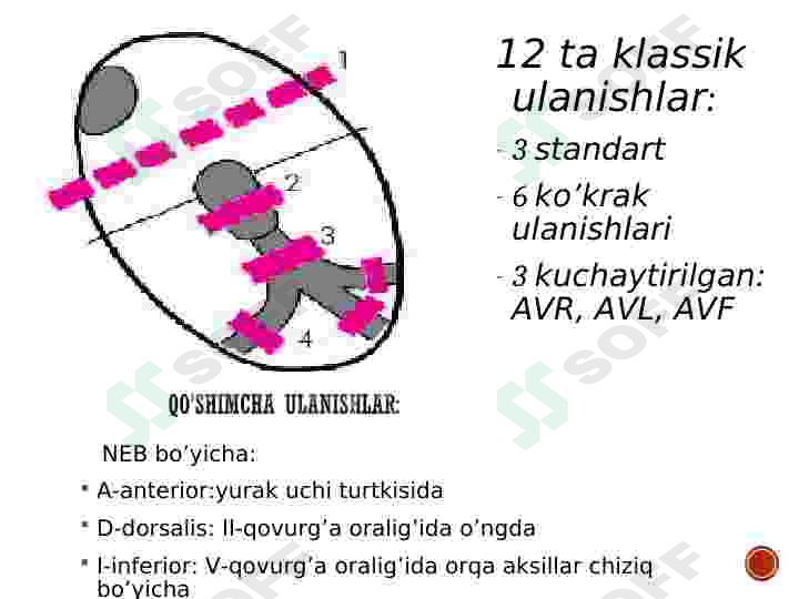 Preview 8