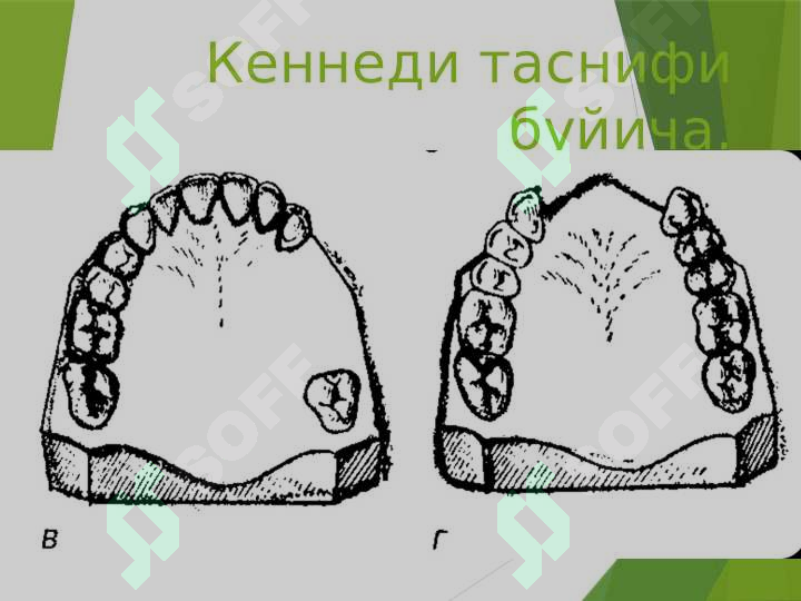 Preview 5