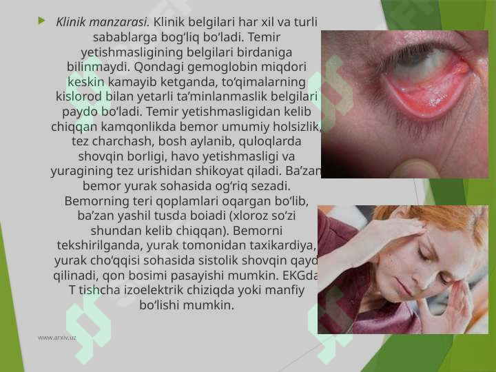Preview 7