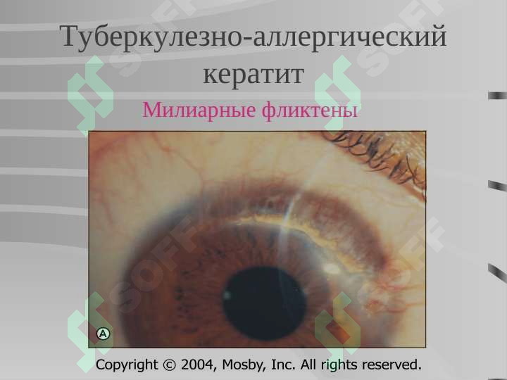 Preview 7