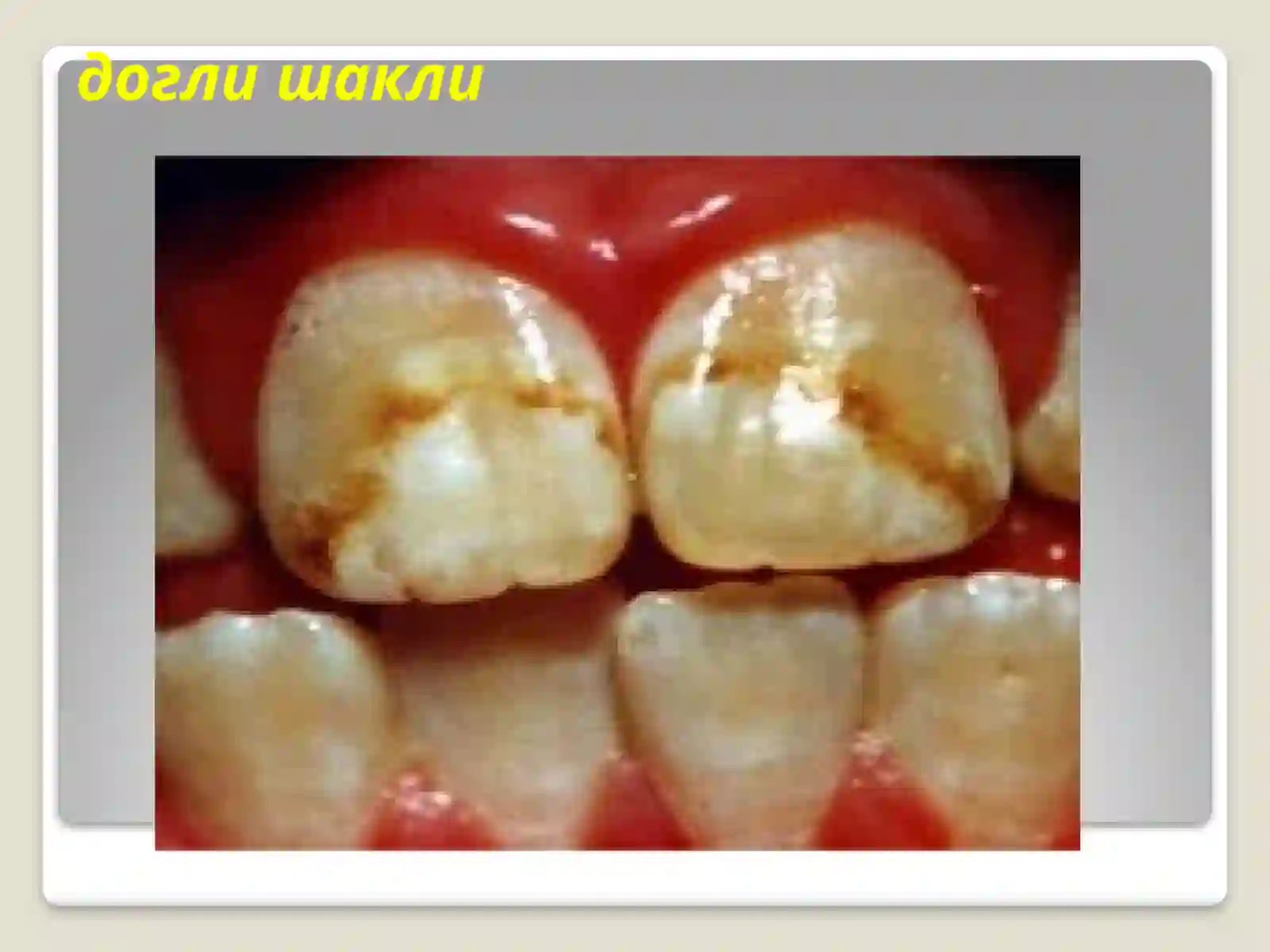 Preview 4