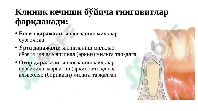 Preview 5