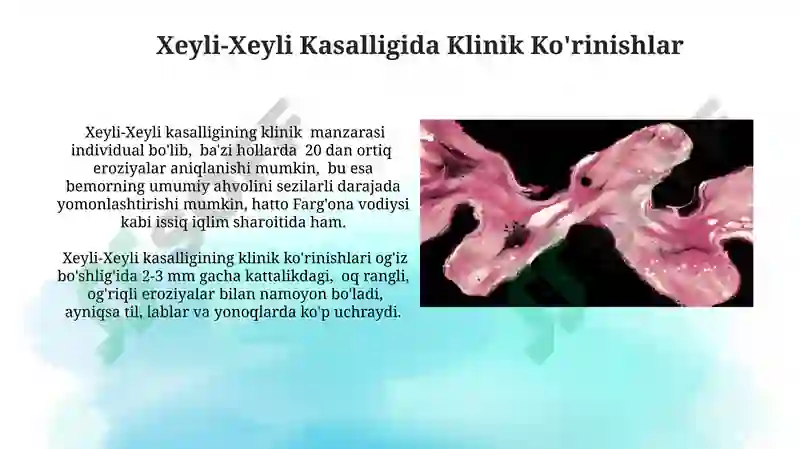 Preview 6