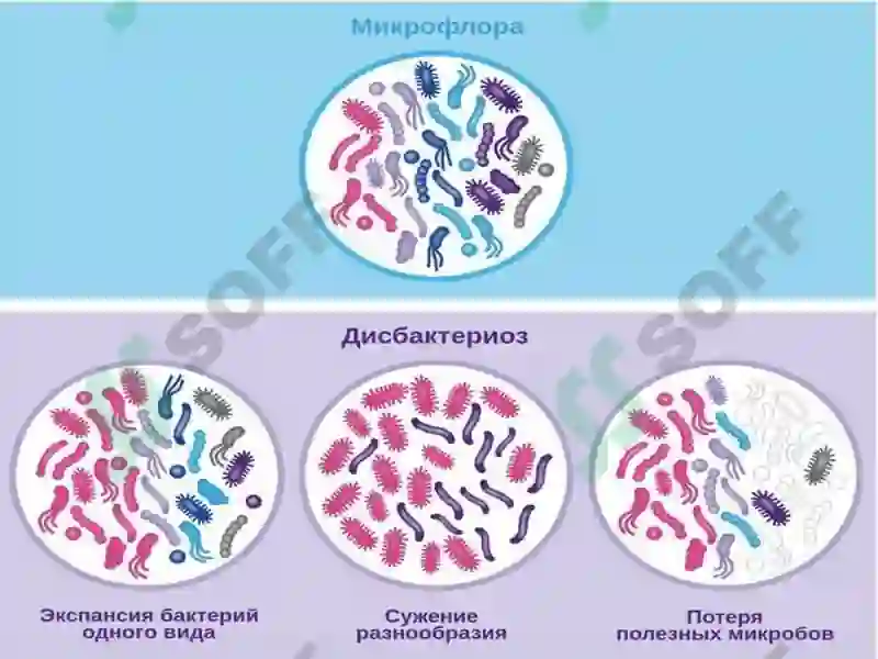 Preview 8