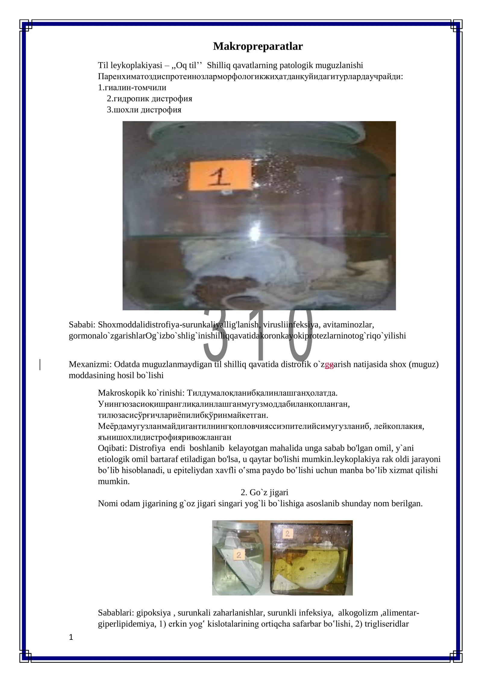 Patanatomiya makropreparatlar