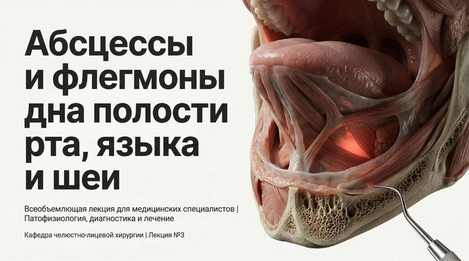 Абсцессы и флегмоны дна нолости рта языка и шеи